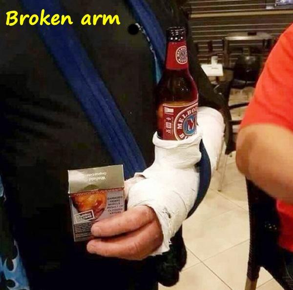 Arm gebrochen