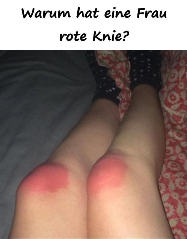 Warum hat eine Frau rote Knie?