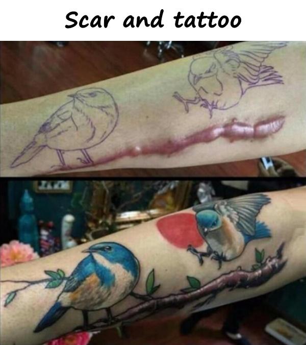 Scar and tattoo