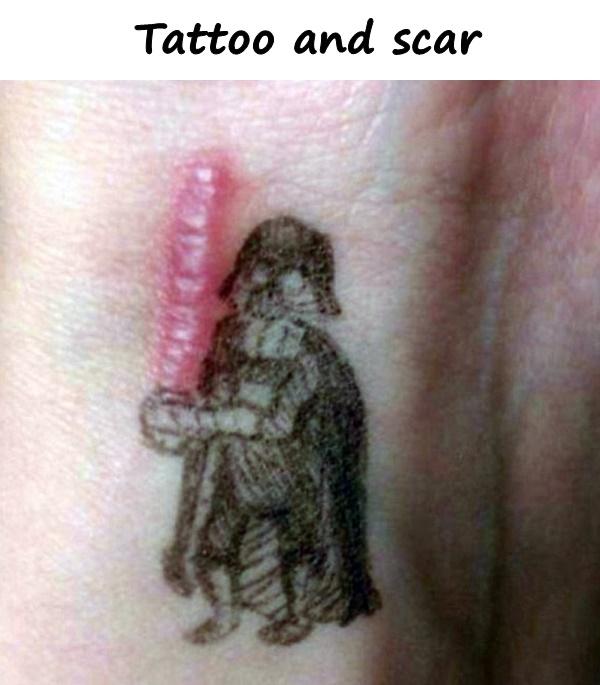 Tattoo and scar