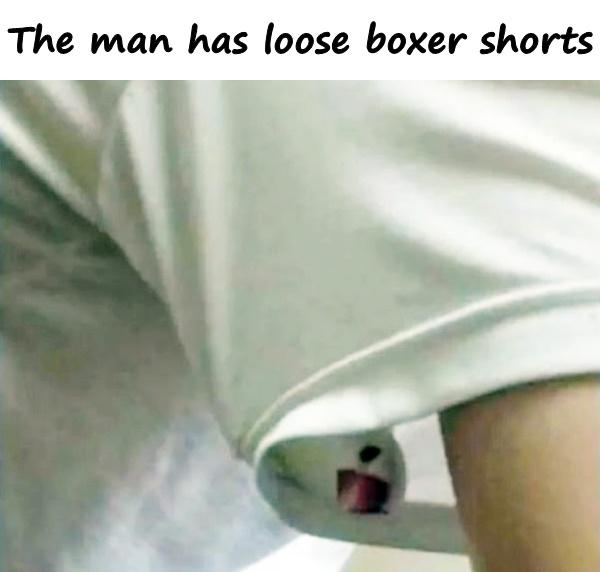The man has loose boxer shorts