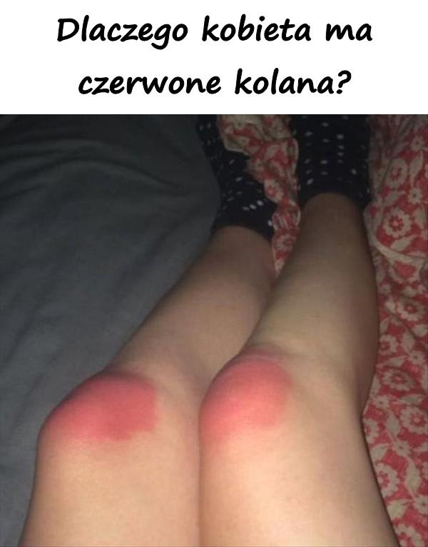 Dlaczego kobieta ma czerwone kolana?
